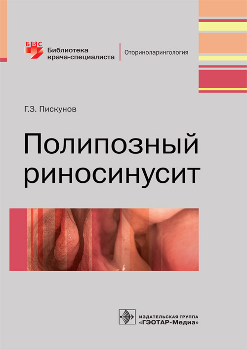 Полипозный риносинусит