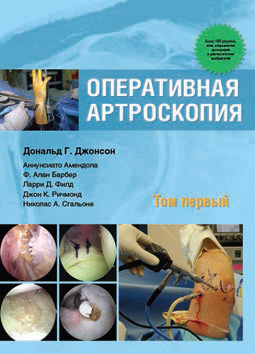 Оперативная артроскопия. Том 1