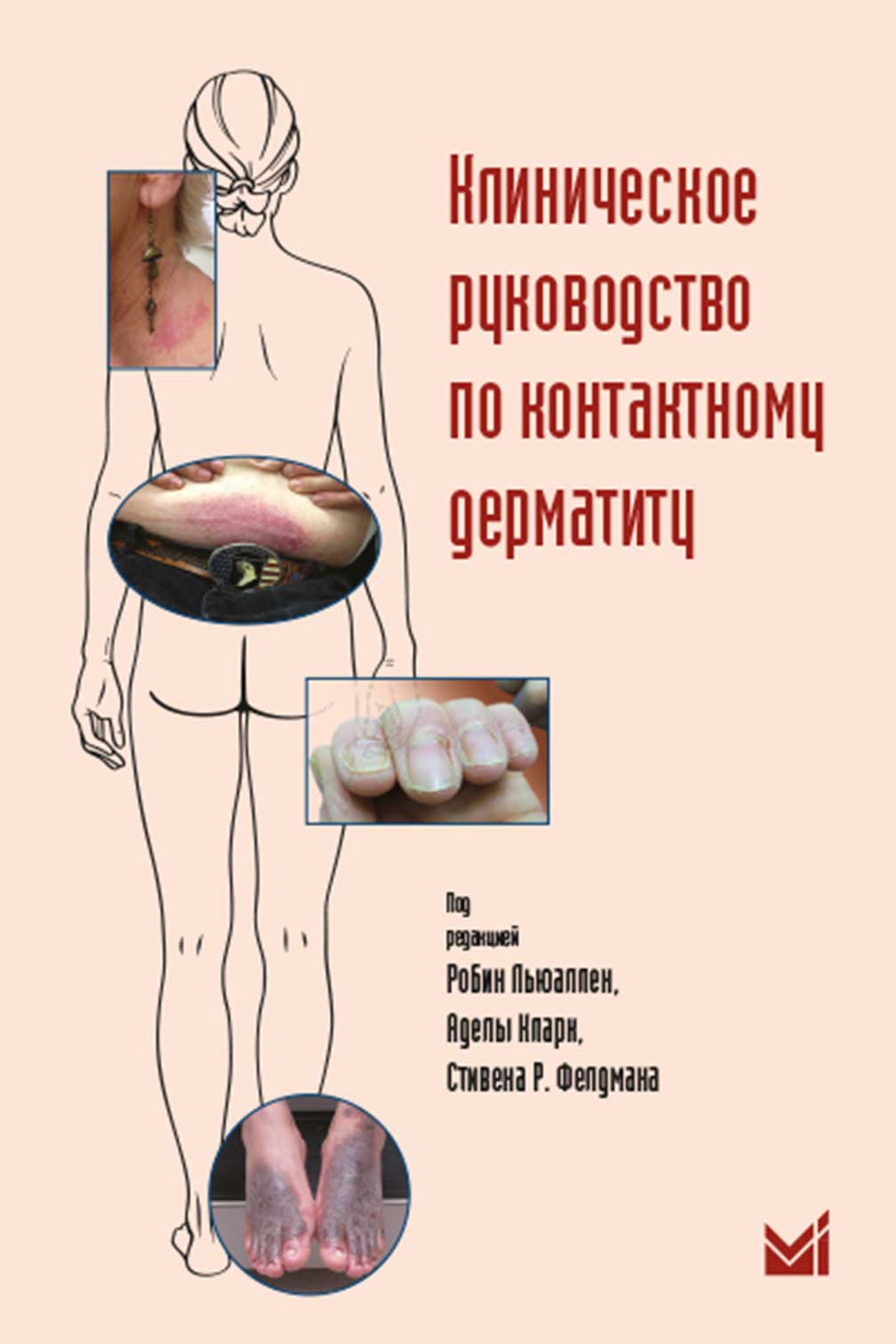 Клиническое руководство по контактному дерматиту