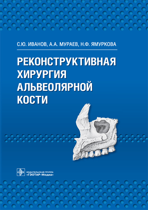 Реконструктивная хирургия альвеолярной кости