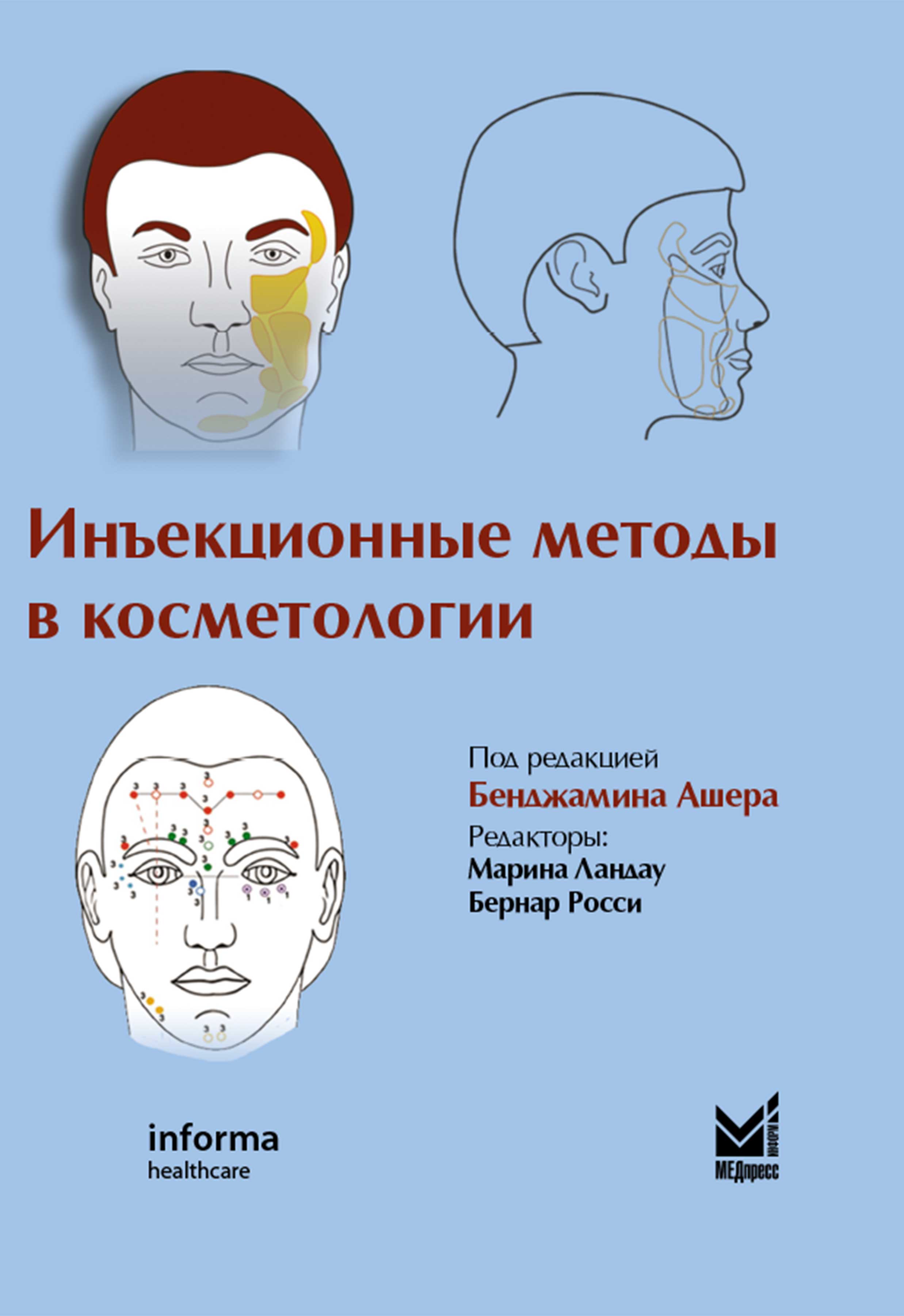 Инъекционные методы в косметологии.