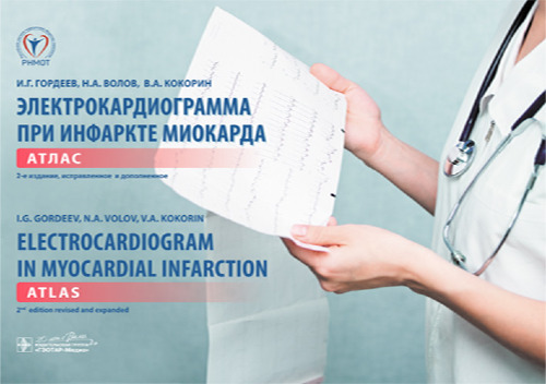 Электрокардиограмма при инфаркте миокарда : атлас на рус. и англ. яз. = Electrocardiogram in myocardial infarction : atlas in russian and english languages . — 2-е изд., испр. и доп. (+ ЭКГ-линейка)