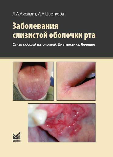 Заболевания слизистой оболочки рта. Связь с общей патологией. Диагностика. Лечение.