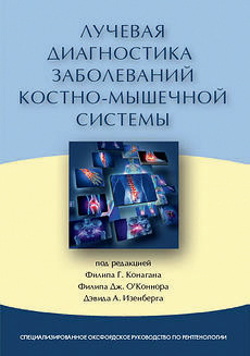 Лучевая диагностика заболеваний костно-мышечной системы