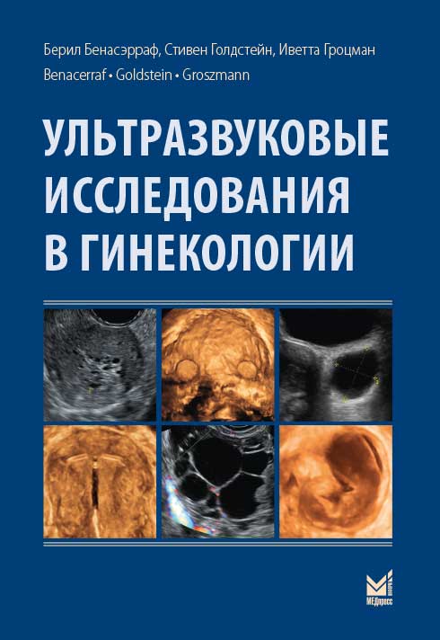Ультразвуковые исследования в гинекологии