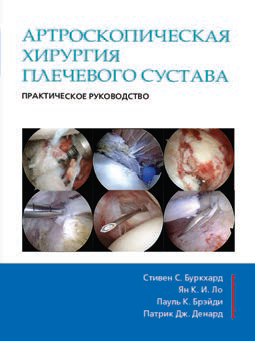 Артроскопическая хирургия плечевого сустава