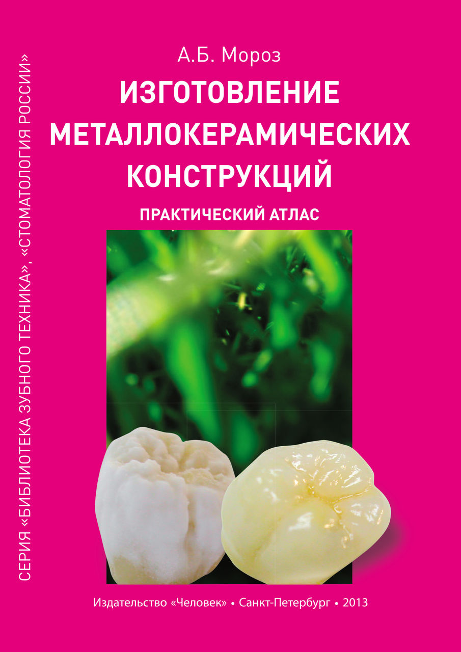 Изготовление металлокерамических конструкций