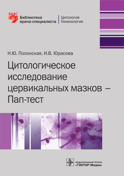 Цитологическое исследование цервикальных мазков — Пап-тест (Серия 