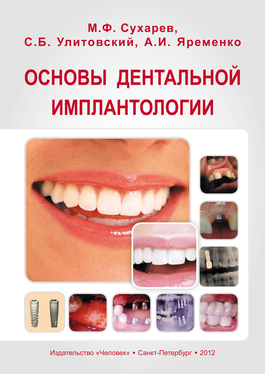 Основы дентальной имплантологии