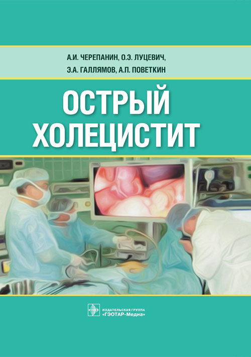 Острый холецистит
