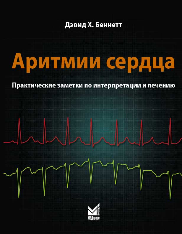 Аритмии сердца