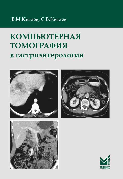 Компьютерная томография в гастроэнтерологии