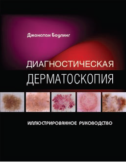 Диагностическая дерматоскопия