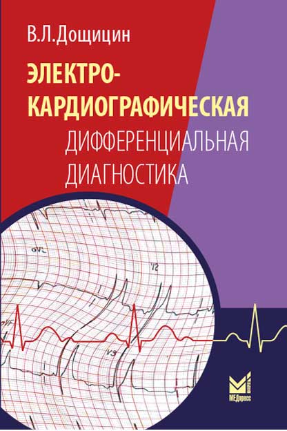 Электрокардиографическая дифференциальная диагностика