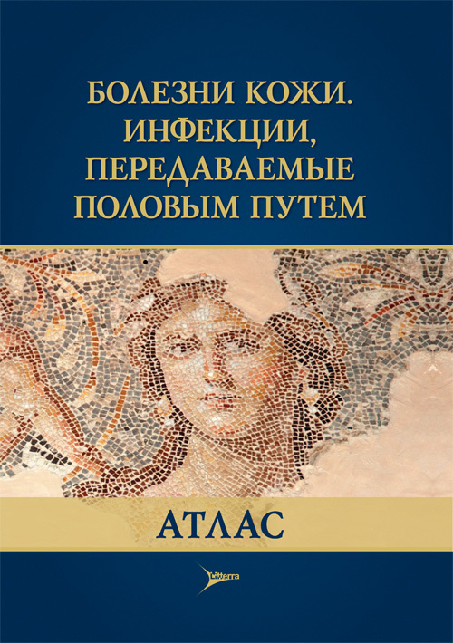 Болезни кожи. Инфекции, передаваемые половым путем: атлас