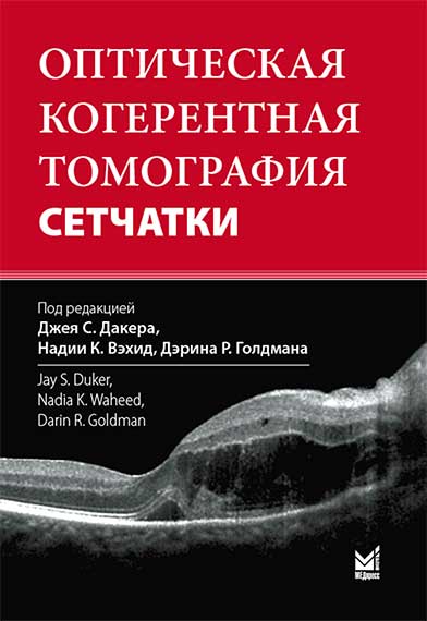 Оптическая когерентная томография сетчатки.