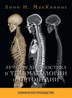 Лучевая диагностика в травматологии и ортопедии