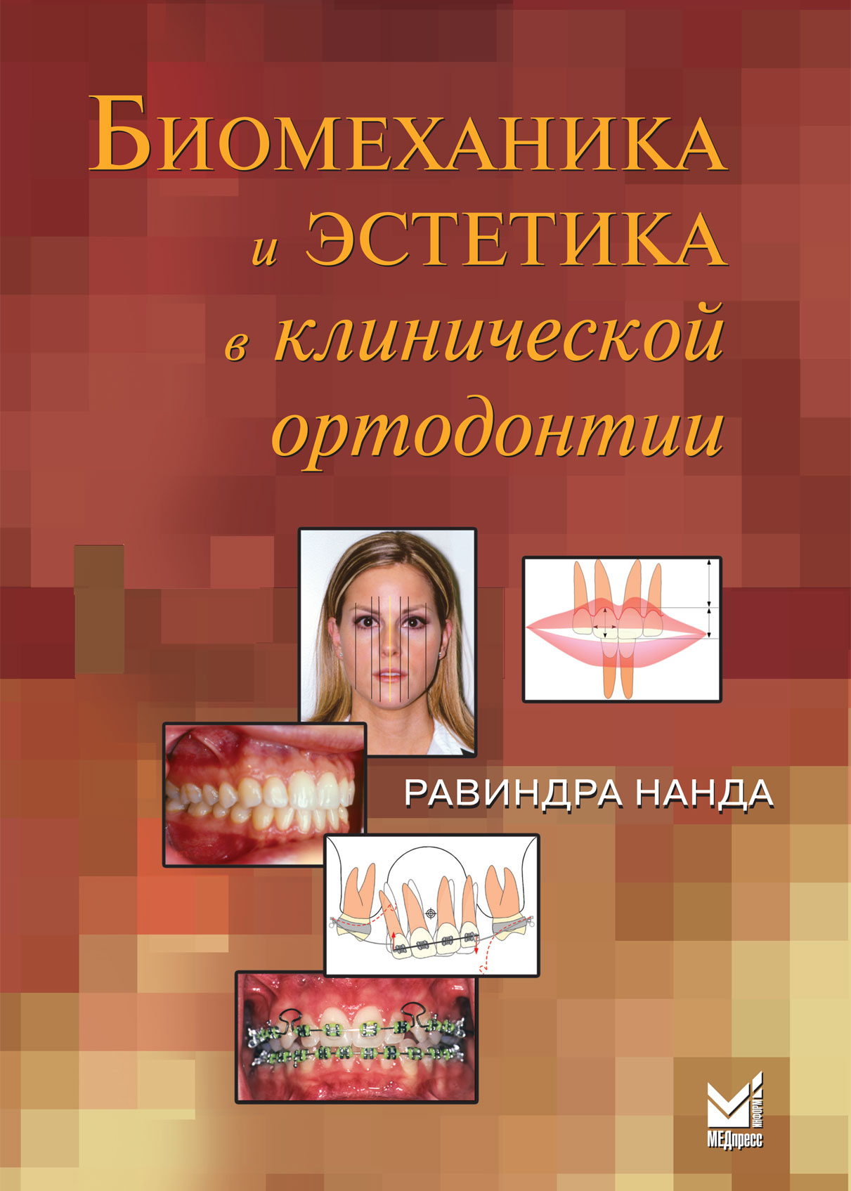 Биомеханика и эстетика в клинической ортодонтии
